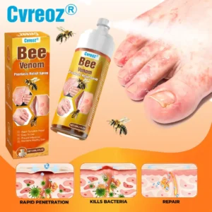 🐝 LIMITED OFFER 60% OFF 💛 Cvreoz® Bee Venom Psoriasis Relief Spray