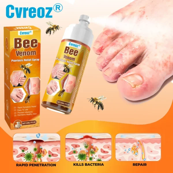 🐝 LIMITED OFFER 60% OFF 💛 Cvreoz® Bee Venom Psoriasis Relief Spray