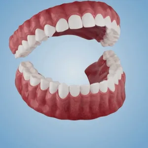 ✅ Official Store: Cvreoz® Adsorptive denture(⏰Limited time discount last 30 minutes⏰)