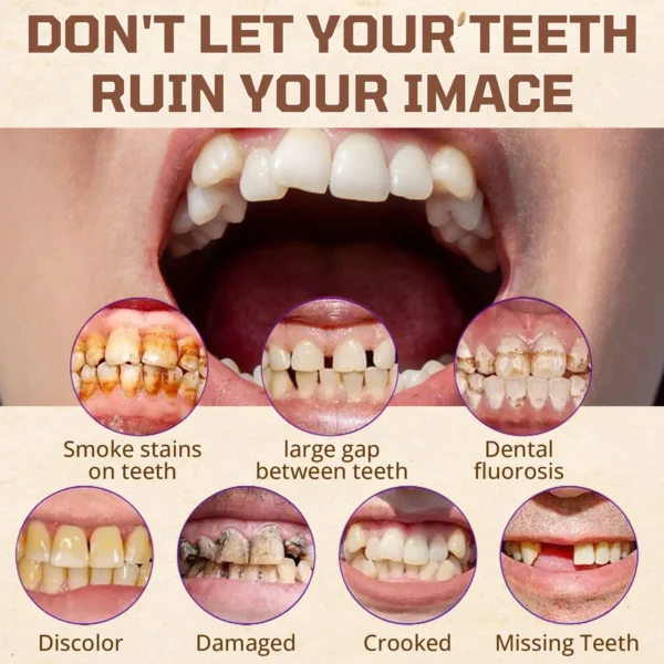 ✅ Official Store: Cvreoz® Adsorptive denture(⏰Limited time discount last 30 minutes⏰)