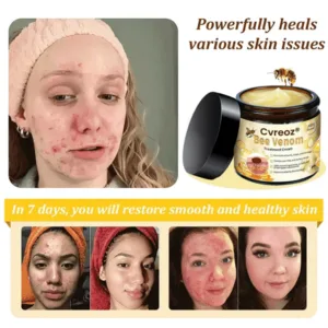 🌟 Official Store | Cvreoz® Bee Venom Skin Treatment Cream🚀LAST DAY 80% OFF(Sagging Skin, Fine Lines, Loss of Firmness, Flat Bust, Drooping Hips, and More) (Copy)