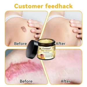 🌟 Official Store | Cvreoz® Bee Venom Skin Treatment Cream🚀LAST DAY 80% OFF(Sagging Skin, Fine Lines, Loss of Firmness, Flat Bust, Drooping Hips, and More) (Copy)
