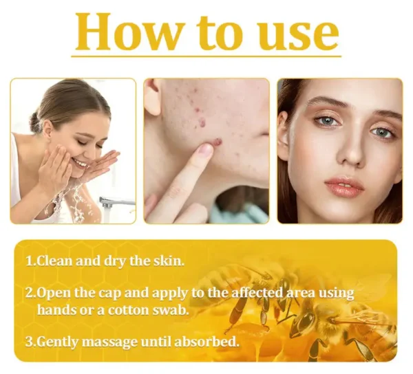 🌟 Official Store | Cvreoz® Bee Venom Skin Treatment Cream🚀LAST DAY 80% OFF(Sagging Skin, Fine Lines, Loss of Firmness, Flat Bust, Drooping Hips, and More) (Copy)