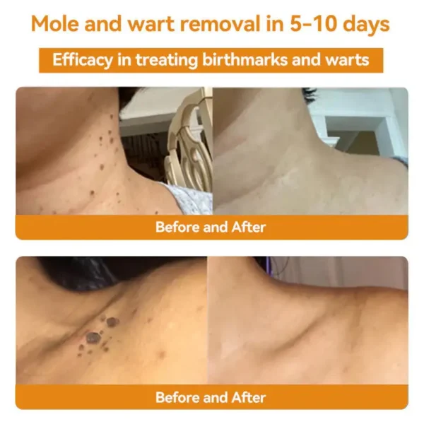 🌟 Official Store | Cvreoz® Bee Venom Skin Treatment Cream🚀LAST DAY 80% OFF(Sagging Skin, Fine Lines, Loss of Firmness, Flat Bust, Drooping Hips, and More) (Copy)