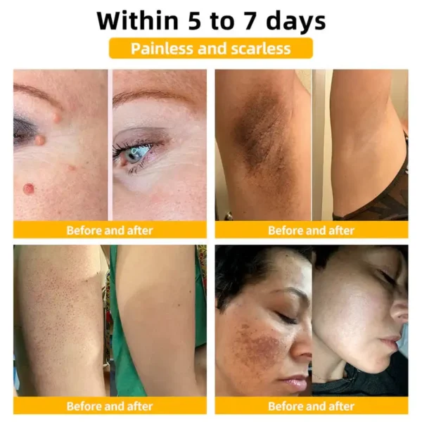 🌟 Official Store | Cvreoz® Bee Venom Skin Treatment Cream🚀LAST DAY 80% OFF(Sagging Skin, Fine Lines, Loss of Firmness, Flat Bust, Drooping Hips, and More) (Copy)