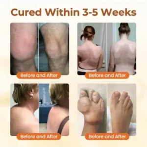 CVREOZ® Premium Curcumin Pain Relief Gel