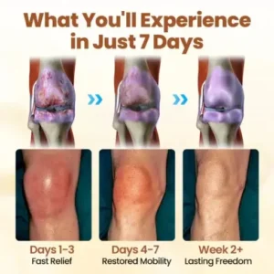 CVREOZ® Premium Curcumin Pain Relief Gel