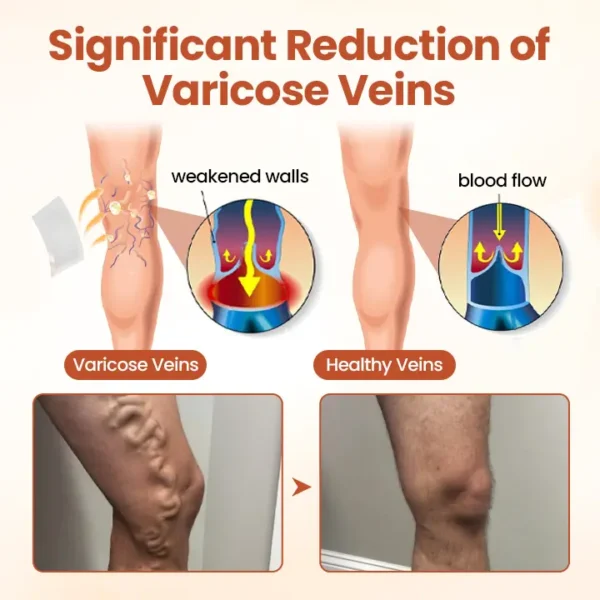 CVREOZ® VeinTarget Nanotech Microneedle Patch
