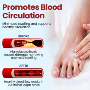 Cvreoz® Diabetic Foot Ulcer Repair Cream✨𝐑𝐞𝐯𝐢𝐭𝐚𝐥𝐢𝐳𝐞 𝐘𝐨𝐮𝐫 𝐅𝐞𝐞𝐭 𝐢𝐧 𝐖𝐞𝐞𝐤𝐬!