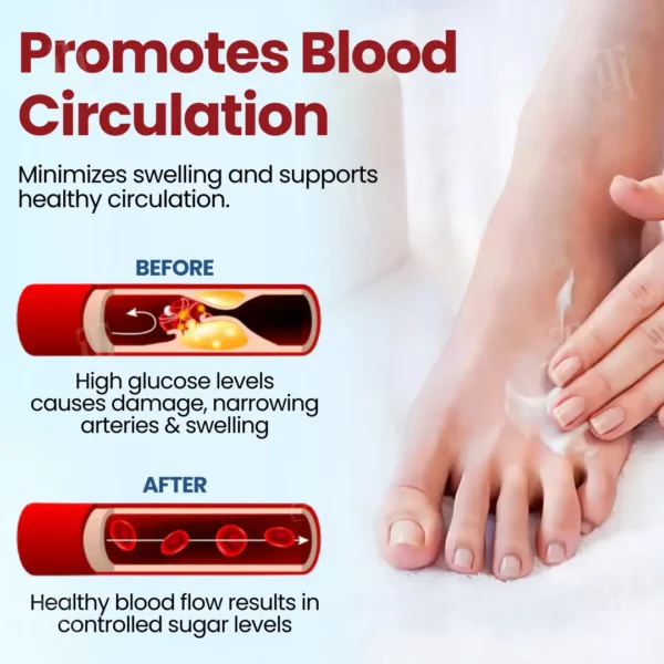 Cvreoz® Diabetic Foot Ulcer Repair Cream✨𝐑𝐞𝐯𝐢𝐭𝐚𝐥𝐢𝐳𝐞 𝐘𝐨𝐮𝐫 𝐅𝐞𝐞𝐭 𝐢𝐧 𝐖𝐞𝐞𝐤𝐬!