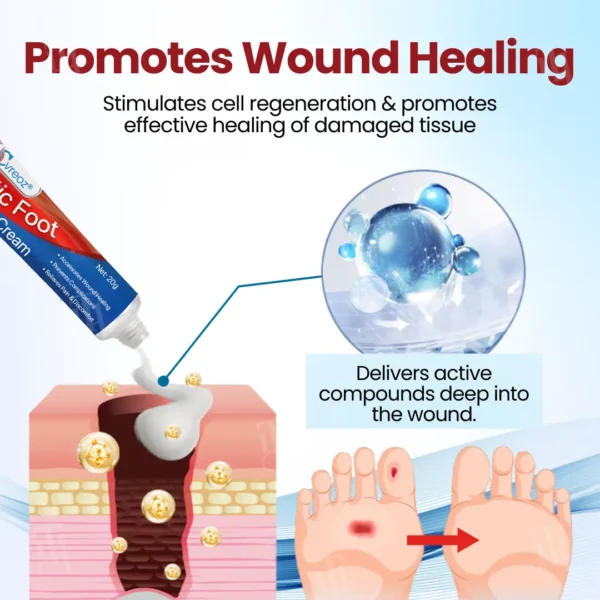 Cvreoz® Diabetic Foot Ulcer Repair Cream✨𝐑𝐞𝐯𝐢𝐭𝐚𝐥𝐢𝐳𝐞 𝐘𝐨𝐮𝐫 𝐅𝐞𝐞𝐭 𝐢𝐧 𝐖𝐞𝐞𝐤𝐬!