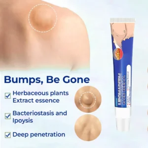 Cvreoz® LipomaDerm Care Cream ⏰LIMITED OFFER 60% OFF🔥