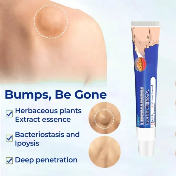 Cvreoz® LipomaDerm Care Cream ⏰LIMITED OFFER 60% OFF🔥