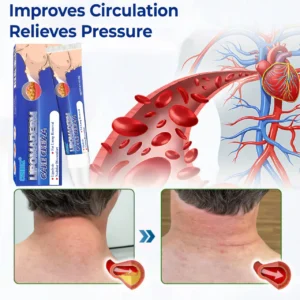 Cvreoz® LipomaDerm Care Cream ⏰LIMITED OFFER 60% OFF🔥