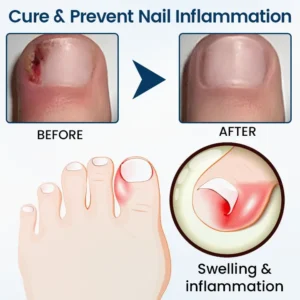 LIMITED TIME SALE OFF 60%🔥 Cvreoz®OnyxiGuard Fungal Repair Herbal Spray