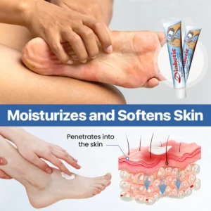 Last Day Promotion: 60% OFF⏰CVREOZ® VitaGluco Diabetes Treatment Cream