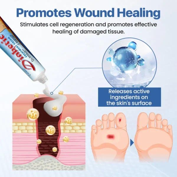 Last Day Promotion: 60% OFF⏰CVREOZ® VitaGluco Diabetes Treatment Cream