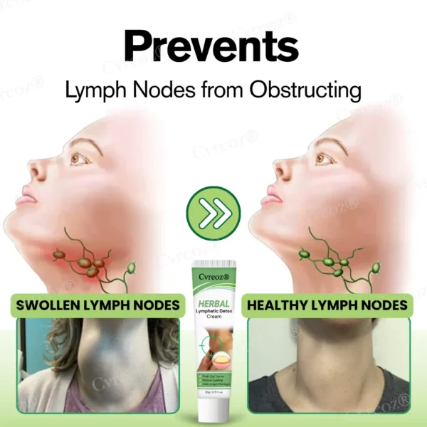 ⏰Last Day Promotion: 60% OFF🔥Cvreoz® Herbal Lymphatic Detox Cream