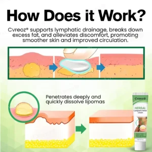 ⏰Last Day Promotion: 60% OFF🔥Cvreoz® Herbal Lymphatic Detox Cream
