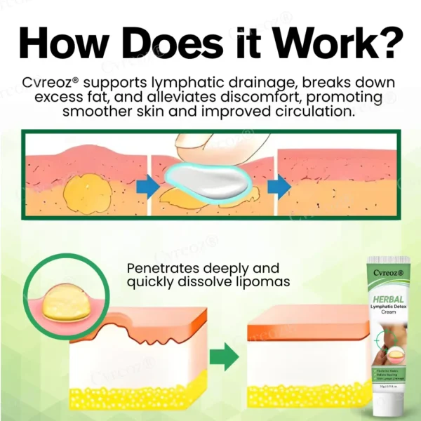 ⏰Last Day Promotion: 60% OFF🔥Cvreoz® Herbal Lymphatic Detox Cream