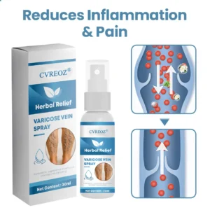 🔥Last Deal: 60% Off🔥 CVREOZ® Herbal Relief Varicose Vein Spray