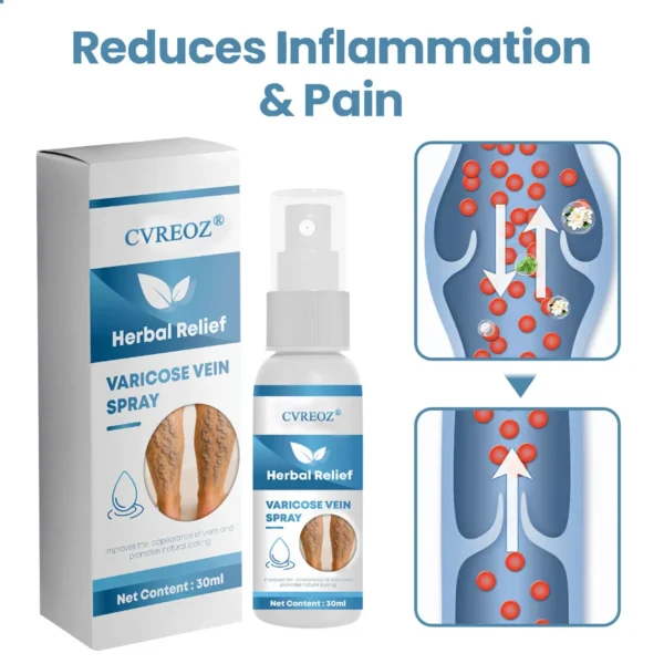 🔥Last Deal: 60% Off🔥 CVREOZ® Herbal Relief Varicose Vein Spray