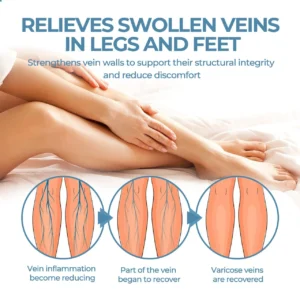 🔥Last Deal: 60% Off🔥 CVREOZ® Herbal Relief Varicose Vein Spray