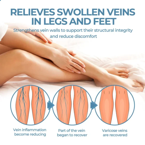 🔥Last Deal: 60% Off🔥 CVREOZ® Herbal Relief Varicose Vein Spray