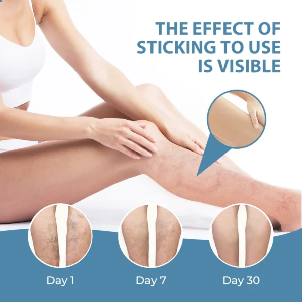 🔥Last Deal: 60% Off🔥 CVREOZ® Herbal Relief Varicose Vein Spray
