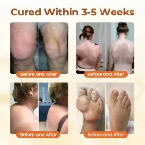 🔥Last Deal: 60% Off🔥 CVREOZ® Premium Curcumin Pain Relief Gel