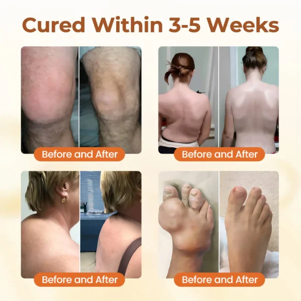 🔥Last Deal: 60% Off🔥 CVREOZ® Premium Curcumin Pain Relief Gel