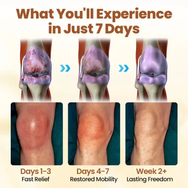 🔥Last Deal: 60% Off🔥 CVREOZ® Premium Curcumin Pain Relief Gel