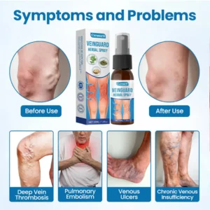 Cvreoz® VeinGuard Herbal Spray