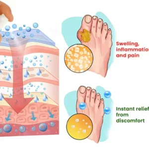 CVREOZ GoutEase Relief Spray