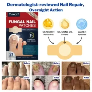Cvreoz® – Fungal Nail Patches