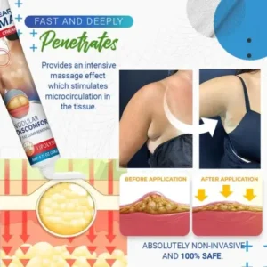 Cvreoz® BumpClear Lipoma Removal Cream