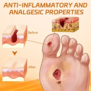 Cvreoz® Diabetes Wound Strong Treatment Cream