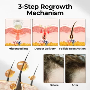Cvreoz® FollicleBoost Micro-Delivery System Advanced Scalp Renewal Kit