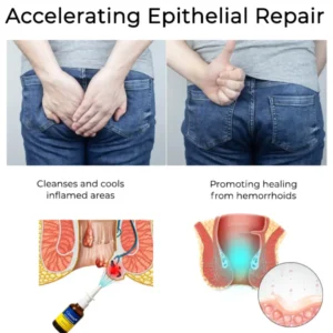 Cvreoz® Herbal Hemorrhoid Treatment Anal Spray