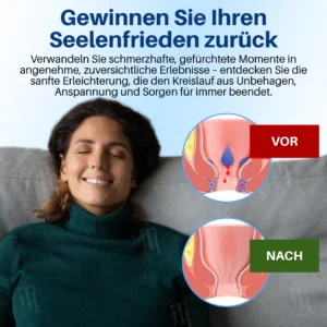✨[Offizieller Shop]Cvreoz® Hämorrhoiden & Fissurencreme