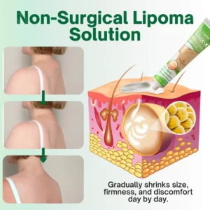 🏷️ EXCLUSIVE DEAL! 50% OFF - Cvreoz® Knot-X Lipoma Dissolve Cream