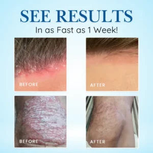 🏷️ EXCLUSIVE DEAL! 64% OFF - Cvreoz® Source-Relief Magnesium Spray