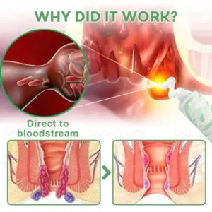 Cvreoz® Hemorrhoid Soothing Cream