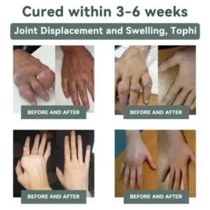 Cvreoz® Nerve Repair &Pain Relief Magnesium Cream